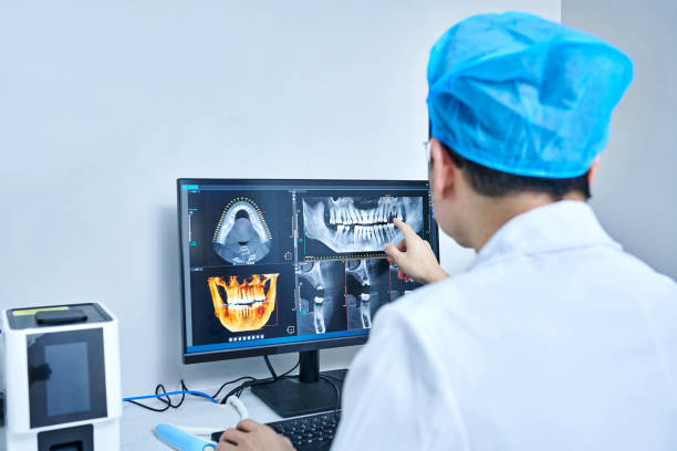 Best Emergency Tooth Extraction in Evansville, WI